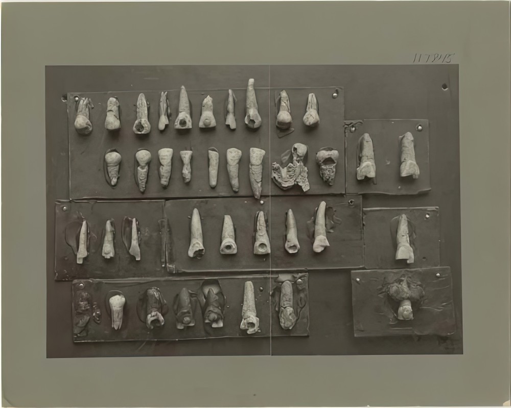 teeth-from-graves-at-copan_313c5d3d-ce52-4ec7-9ea3-16e7c40a11e8.jpg